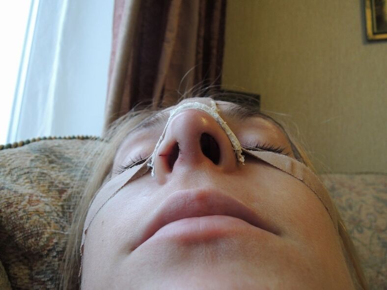 αναμόρφωση